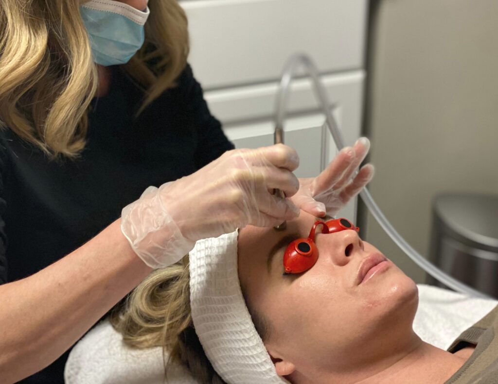 exfoliation stage of the best anti-aging facial in Kansas City