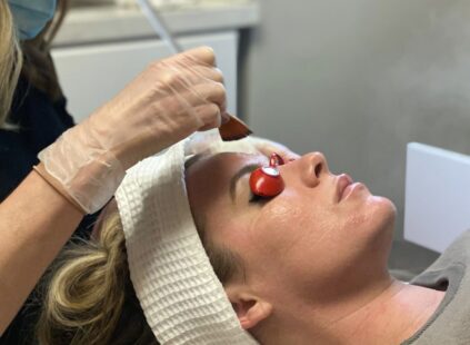 Trans4mation medical facial