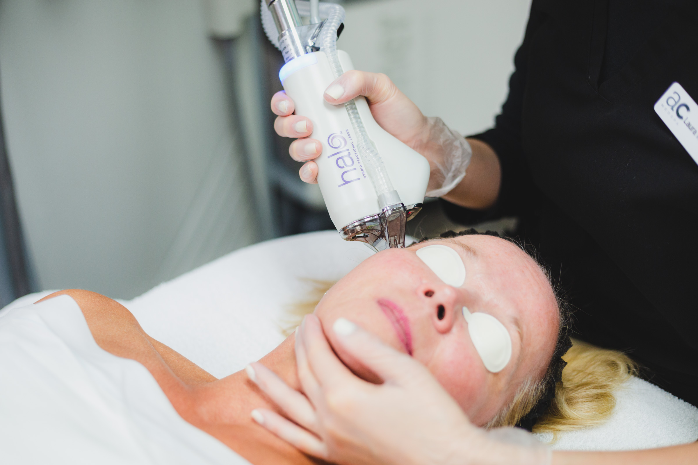 woman receiving halo laser treatment at aestheticare