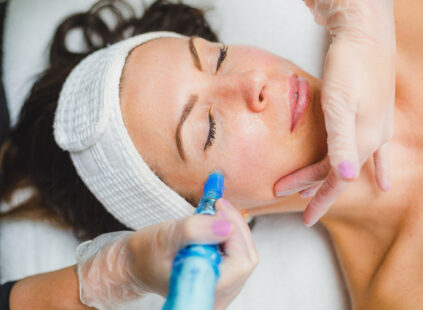 Microneedling in Kansas City