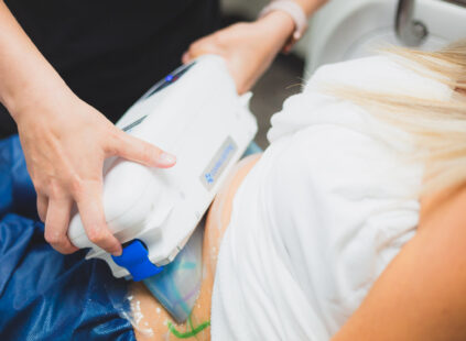 coolsculpting in kansas city