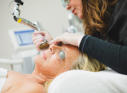 Microlaser Peel in Kansas City