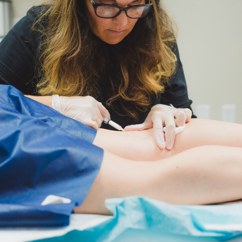 Sclerotherapy in Kansas City