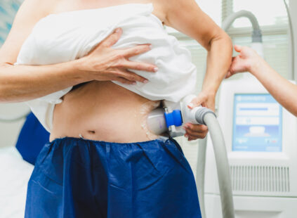 happy woman getting coolsculpting