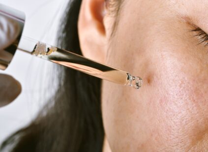 woman receiving an acne facial in Kansas City