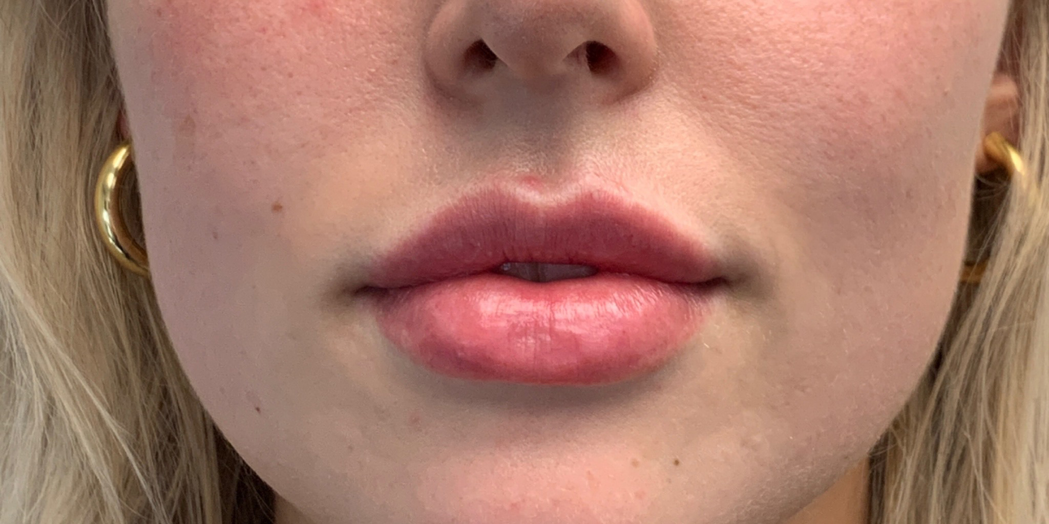 Permanent Lip Color - After