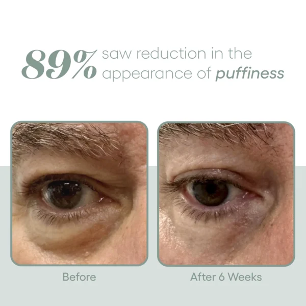 ( plated ) Eye Serum - Image 3