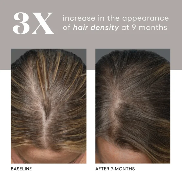( plated ) Hair Serum - Image 4