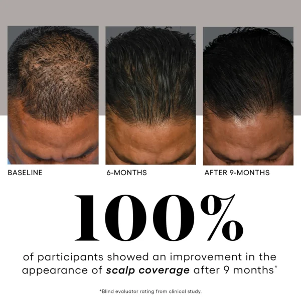 ( plated ) Hair Serum - Image 5