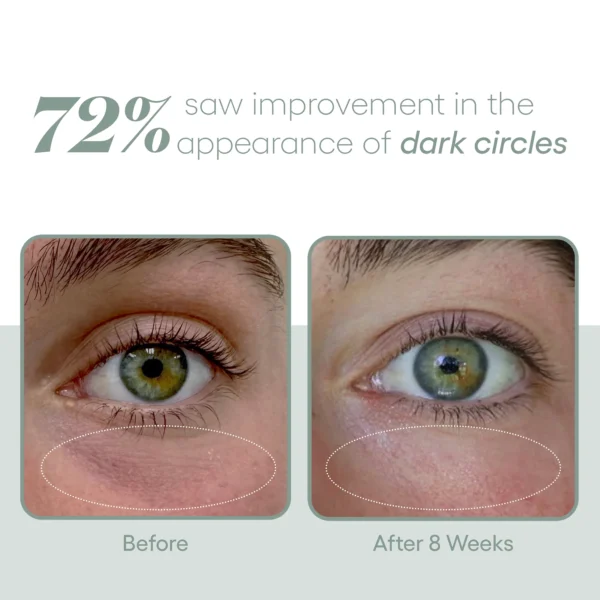 ( plated ) Eye Serum - Image 4