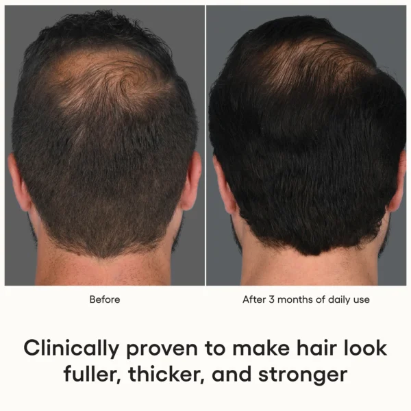 ( plated ) Hair Serum - Image 9